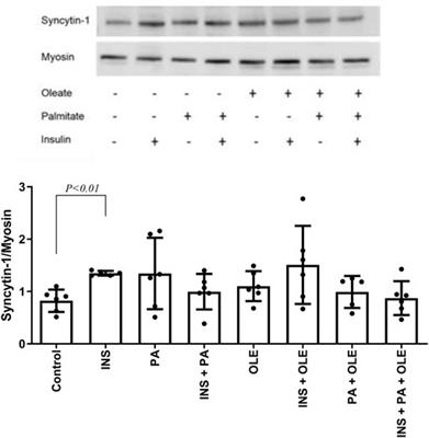 Increased Expression of Syncytin-1 in Skeletal Muscle of Humans With Increased Body Mass Index